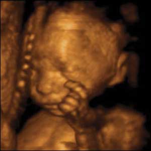 At 22 weeks gestation babies are capable of fine hand and finger movements. In a short space of time this baby scratches, rubs and pats his cheek before doing the same to his nose.